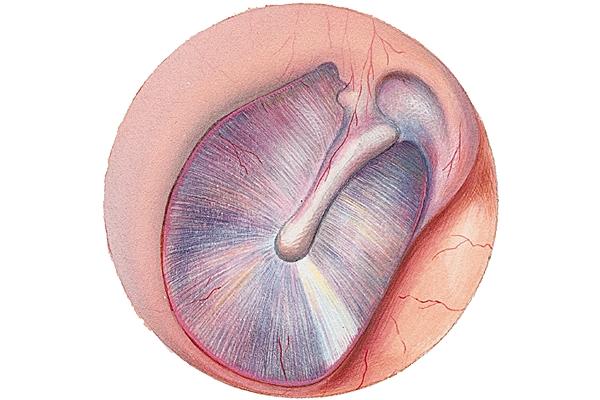 Biofabrication for the eardrum