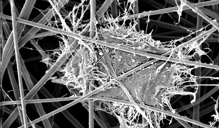 Flexible Ceramics nanofibers for bone scaffolds